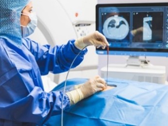 Imactis® CT-Navigation