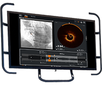 Zobrazovanie – OCT integrovaný systém/ mobilný