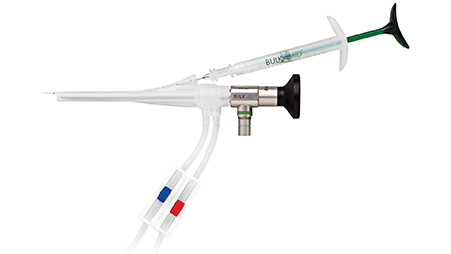 Bulkamid™ uretrálny bulkingový systém 