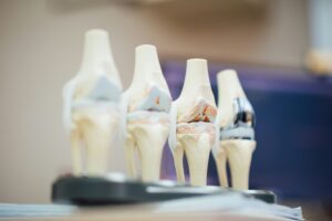 Rýchlejšie hojenie po operácii kĺbu: moderná medicína ponúka riešenie
